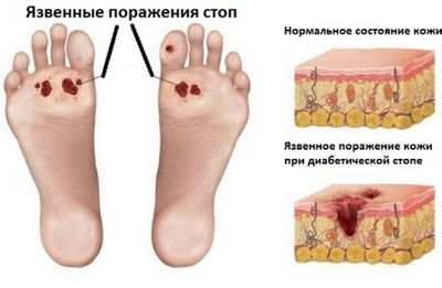 стопа стопа
