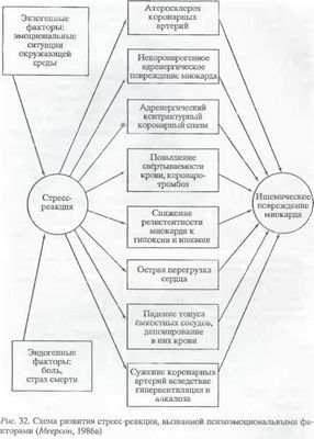 стресс стресс