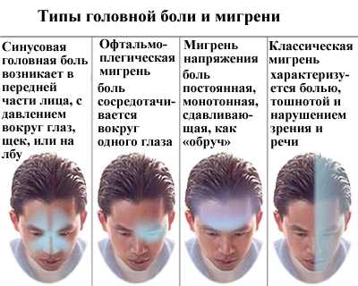 Ботокс для лечения головных болей 