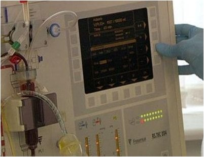 пересадка пересадка