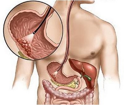 говорит Хербст говорит Хербст