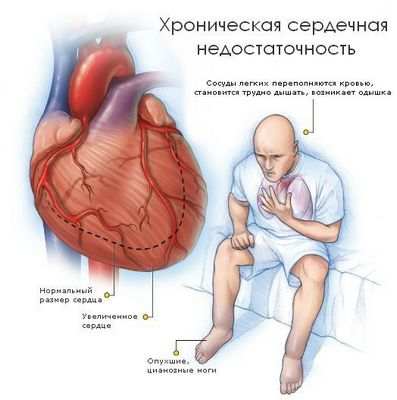 сахар