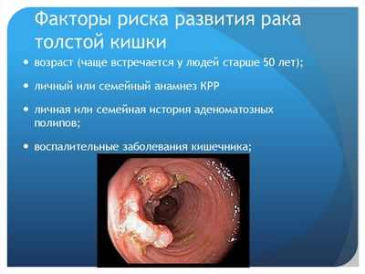 Воспалительное заболевание кишечника повышает риск меланомы