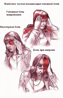 Расстройство мозгового давления, вызывающее головную боль и проблемы со зрением