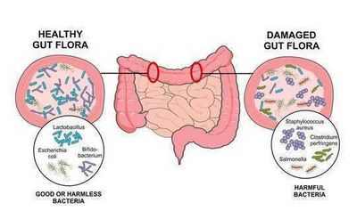 5 вещей, которые вы можете сделать, чтобы сделать свой микробиом более здоровым