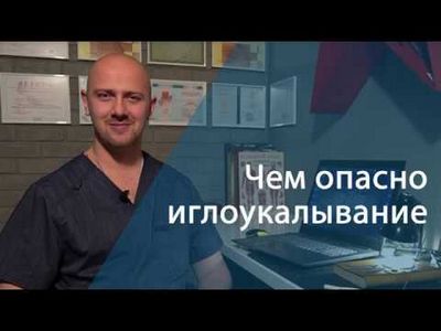 иглоукалывание